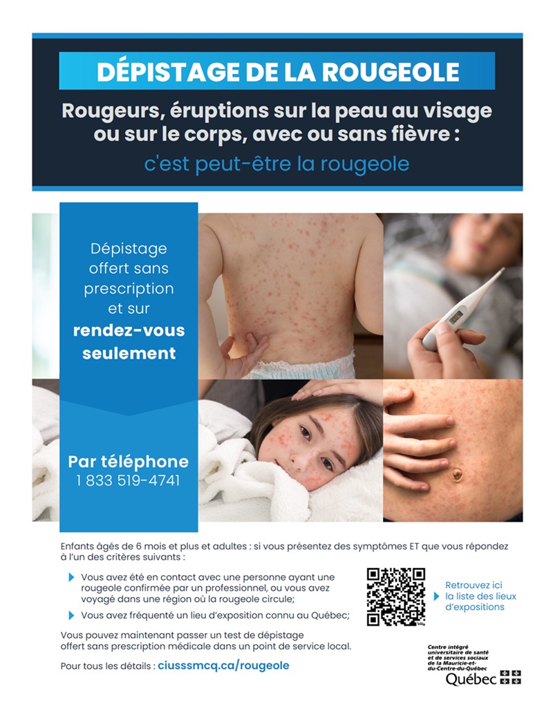 Dépistage Rougeole